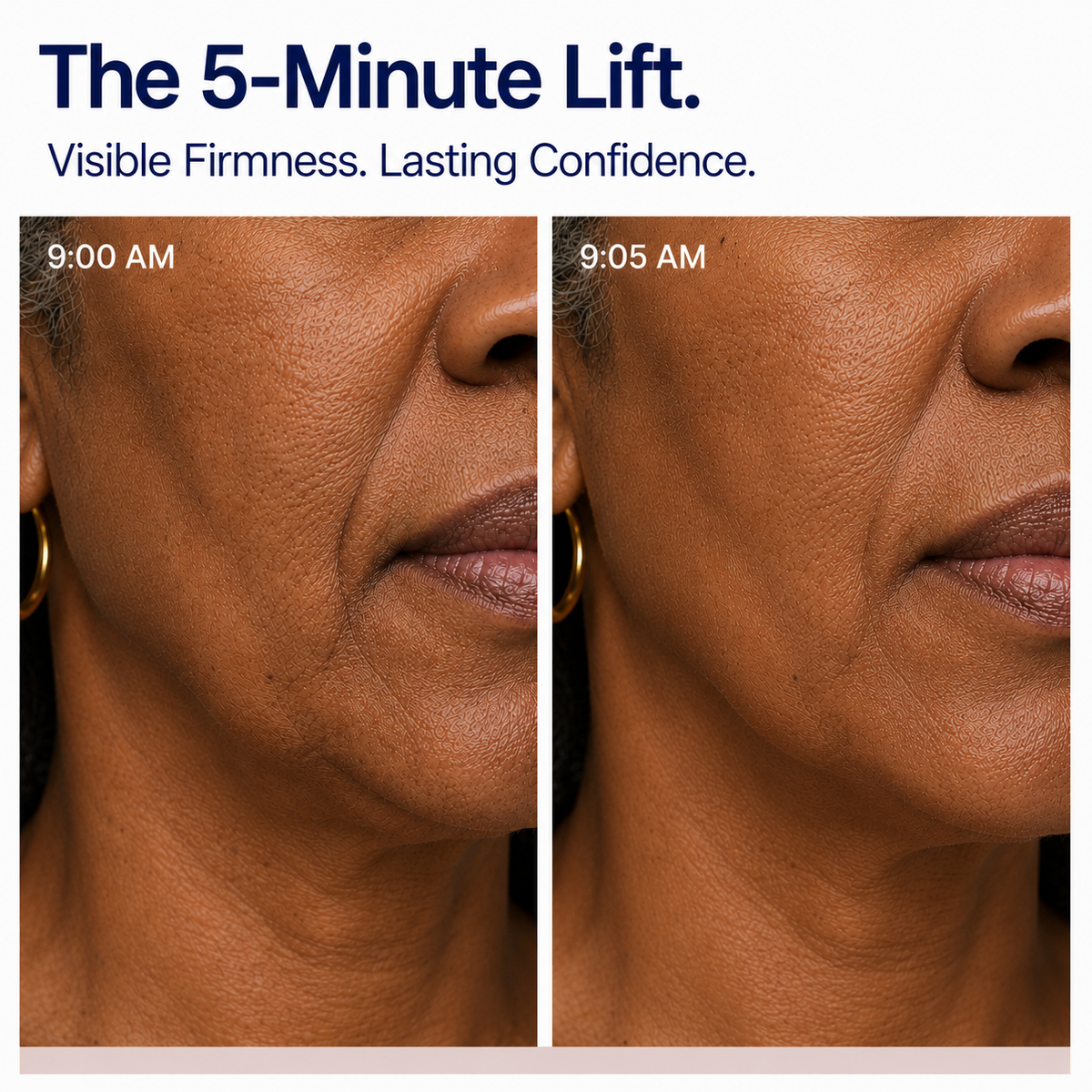 Nayavie 5-Minute Lift™.