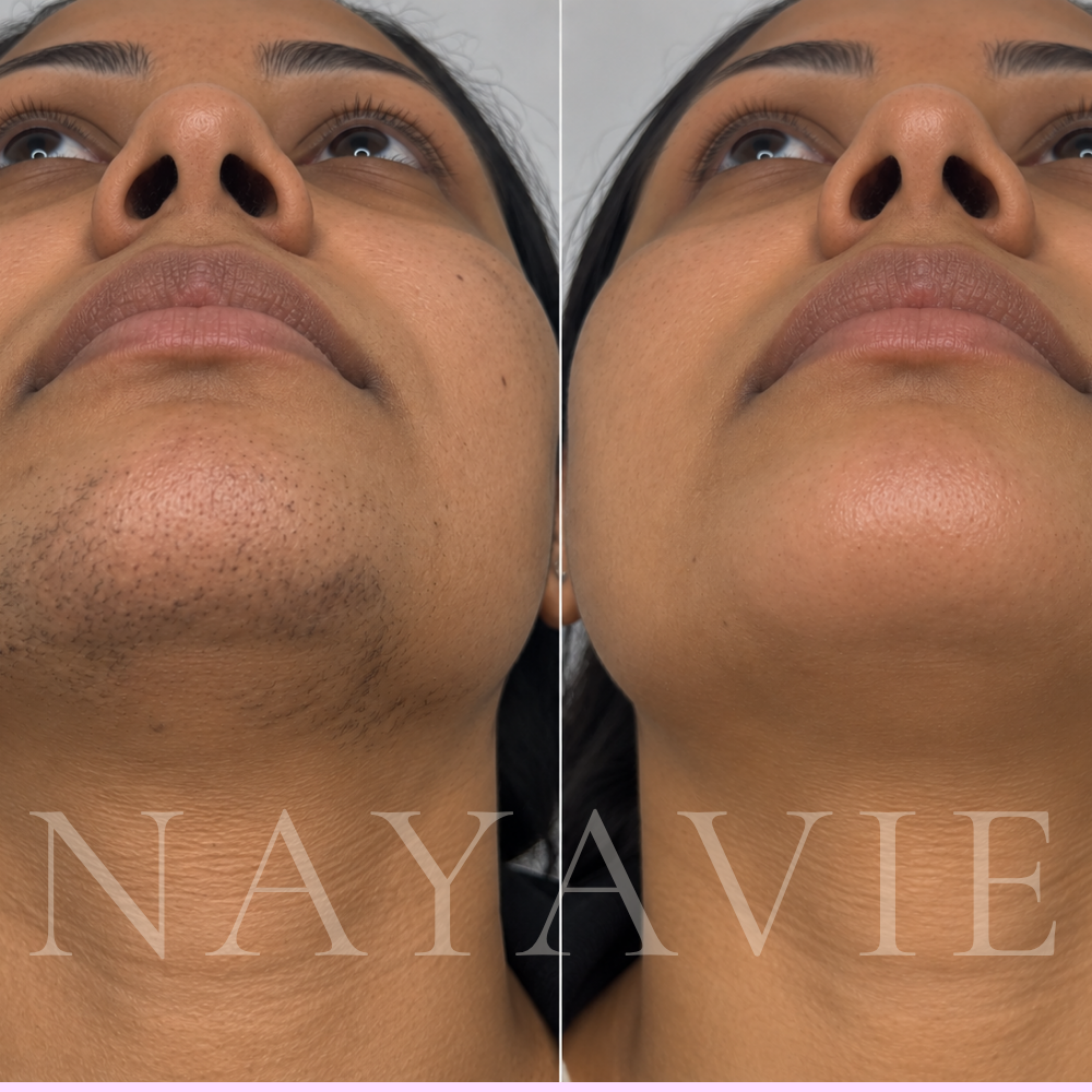Nayavie - The Root Serum