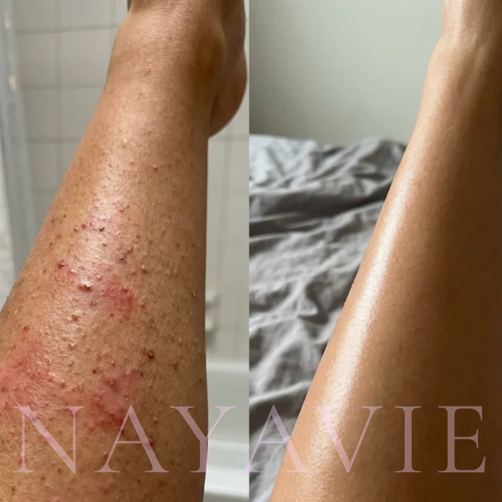 Nayavie - The Root Serum