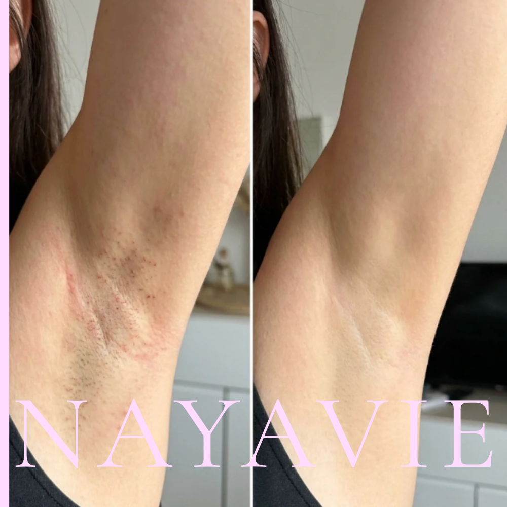 Nayavie - The Root Serum