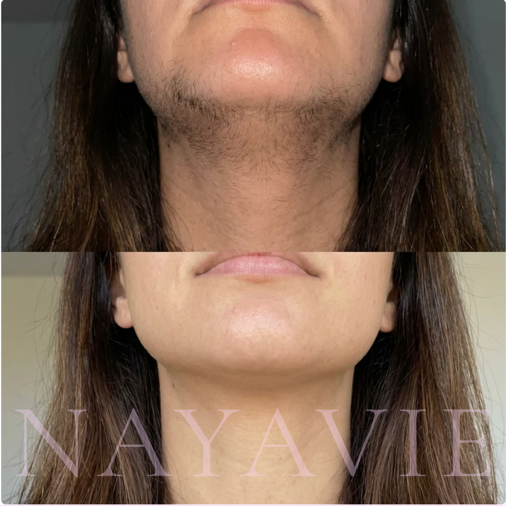 Nayavie - The Root Serum